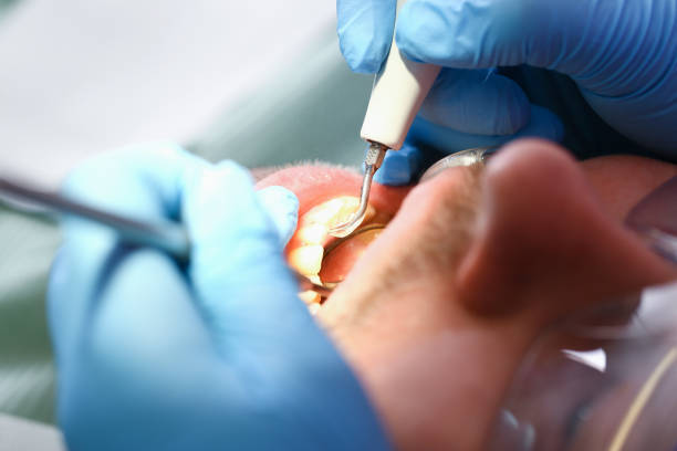 Best Emergency Treatment for Toothache in Riverdale Park, CA