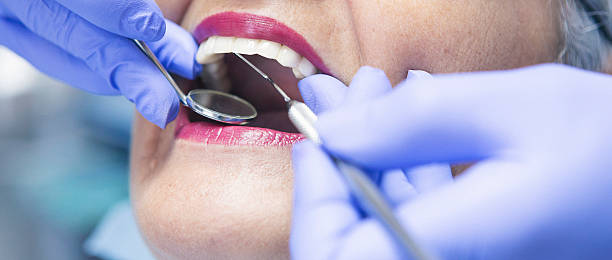 Best Emergency Broken Tooth Repair in Riverdale Park, CA
